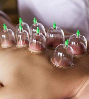 Dry Needling 2